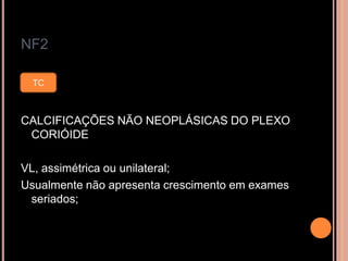 NF2
CALCIFICAÇÕES NÃO NEOPLÁSICAS DO PLEXO
CORIÓIDE
VL, assimétrica ou unilateral;
Usualmente não apresenta crescimento em exames
seriados;
TC
 
