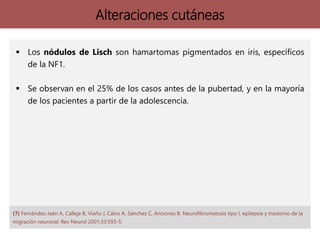 Alteraciones cutáneas
 Los nódulos de Lisch son hamartomas pigmentados en iris, específicos
de la NF1.
 Se observan en el 25% de los casos antes de la pubertad, y en la mayoría
de los pacientes a partir de la adolescencia.
(7) Fernández-Jaén A, Calleja B, Viaño J, Calvo A, Sánchez C, Anciones B. Neurofibromatosis tipo I, epilepsia y trastorno de la
migración neuronal. Rev Neurol 2001;33:593-5.
 