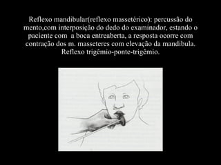 Reflexo mandibular(reflexo massetérico): percussão do mento,com interposição do dedo do examinador, estando o paciente com  a boca entreaberta, a resposta ocorre com contração dos m. masseteres com elevação da mandibula. Reflexo trigêmio-ponte-trigêmio. 
