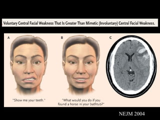 NEJM 2004 