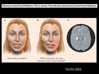 NEJM 2004 