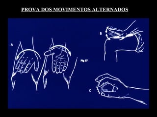 PROVA DOS MOVIMENTOS ALTERNADOS 