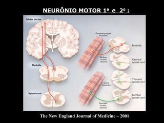 NEURÔNIO MOTOR 1 0  e  2 0  : The New England Journal of Medicine – 2001 