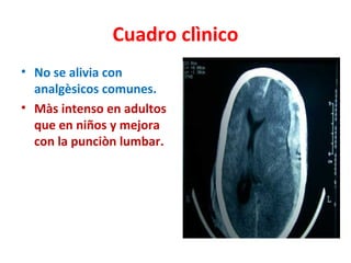 Cuadro clìnico
• No se alivia con
  analgèsicos comunes.
• Màs intenso en adultos
  que en niños y mejora
  con la punciòn lumbar.
 
