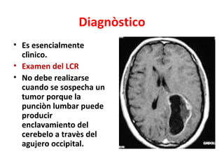 Diagnòstico
• Es esencialmente
  clìnico.
• Examen del LCR
• No debe realizarse
  cuando se sospecha un
  tumor porque la
  punciòn lumbar puede
  producir
  enclavamiento del
  cerebelo a travès del
  agujero occipital.
 