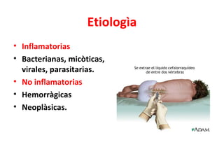 Etiologìa
• Inflamatorias
• Bacterianas, micòticas,
  virales, parasitarias.
• No inflamatorias
• Hemorràgicas
• Neoplàsicas.
 