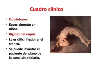 Cuadro clìnico
• Opistòtonos:
• Especialmente en
  niños.
• Rigidez del raquis:
• Le es difìcil flexionar el
  tronco.
• Se puede levantar el
  paciente del plano de
  la cama sin doblarlo.
 