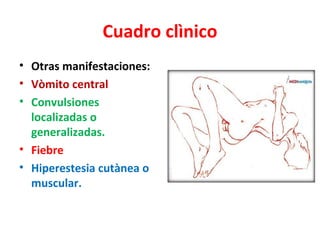 Cuadro clìnico
• Otras manifestaciones:
• Vòmito central
• Convulsiones
  localizadas o
  generalizadas.
• Fiebre
• Hiperestesia cutànea o
  muscular.
 