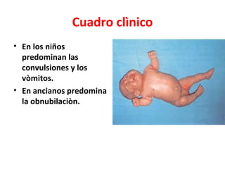 Cuadro clìnico
• En los niños
  predominan las
  convulsiones y los
  vòmitos.
• En ancianos predomina
  la obnubilaciòn.
 