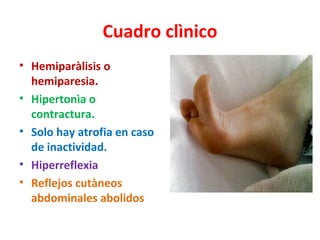 Cuadro clìnico
• Hemiparàlisis o
  hemiparesia.
• Hipertonìa o
  contractura.
• Solo hay atrofia en caso
  de inactividad.
• Hiperreflexia
• Reflejos cutàneos
  abdominales abolidos
 