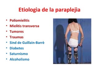 Etiologìa de la paraplejìa
•   Poliomielitis
•   Mielitis transversa
•   Tumores
•   Traumas
•   Sind de Guillain-Barrè
•   Diabetes
•   Saturnismo
•   Alcoholismo
 