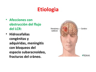 Etiologìa
• Afecciones con
  obstrucciòn del flujo
  del LCR:
• Hidrocefalias
  congènitas y
  adquiridas, meningitis
  con bloqueos del
  espacio subaracnoideo,
  fracturas del cràneo.
 