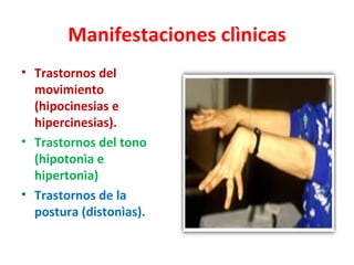 Manifestaciones clìnicas
• Trastornos del
  movimiento
  (hipocinesias e
  hipercinesias).
• Trastornos del tono
  (hipotonìa e
  hipertonìa)
• Trastornos de la
  postura (distonìas).
 