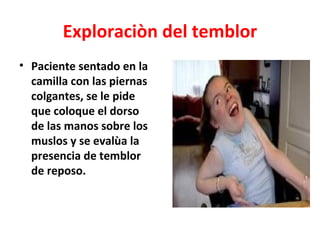 Exploraciòn del temblor
• Paciente sentado en la
  camilla con las piernas
  colgantes, se le pide
  que coloque el dorso
  de las manos sobre los
  muslos y se evalùa la
  presencia de temblor
  de reposo.
 