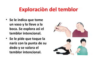 Exploraciòn del temblor
• Se le indica que tome
  un vaso y lo lleve a la
  boca. Se explora asì el
  temblor intencional.
• Se le pide que toque la
  nariz con la punta de su
  dedo y se valora el
  temblor intencional.
 