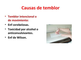 Causas de temblor
• Temblor intencional o
  de movimiento:
• Enf cerebelosas.
• Toxicidad por alcohol o
  anticonvulsivantes.
• Enf de Wilson.
 