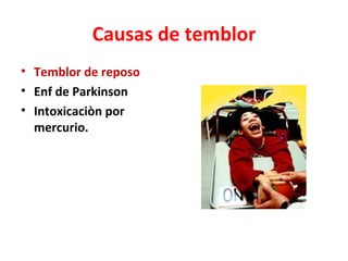 Causas de temblor
• Temblor de reposo
• Enf de Parkinson
• Intoxicaciòn por
  mercurio.
 