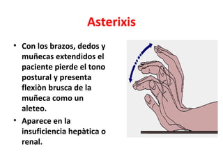 Asterixis
• Con los brazos, dedos y
  muñecas extendidos el
  paciente pierde el tono
  postural y presenta
  flexiòn brusca de la
  muñeca como un
  aleteo.
• Aparece en la
  insuficiencia hepàtica o
  renal.
 