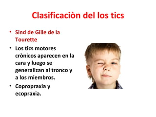 Clasificaciòn del los tics
• Sind de Gille de la
  Tourette
• Los tics motores
  crònicos aparecen en la
  cara y luego se
  generalizan al tronco y
  a los miembros.
• Copropraxia y
  ecopraxia.
 