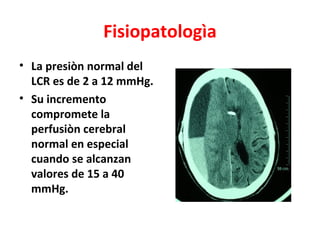 Fisiopatologìa
• La presiòn normal del
  LCR es de 2 a 12 mmHg.
• Su incremento
  compromete la
  perfusiòn cerebral
  normal en especial
  cuando se alcanzan
  valores de 15 a 40
  mmHg.
 