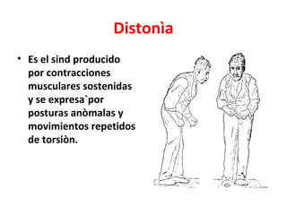 Distonìa
• Es el sind producido
  por contracciones
  musculares sostenidas
  y se expresa`por
  posturas anòmalas y
  movimientos repetidos
  de torsiòn.
 
