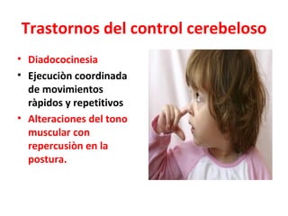 Trastornos del control cerebeloso
• Diadococinesia
• Ejecuciòn coordinada
  de movimientos
  ràpidos y repetitivos
• Alteraciones del tono
  muscular con
  repercusiòn en la
  postura.
 