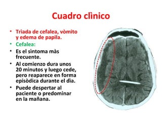 Cuadro clìnico
• Trìada de cefalea, vòmito
  y edema de papila.
• Cefalea:
• Es el sìntoma màs
  frecuente.
• Al comienzo dura unos
  20 minutos y luego cede,
  pero reaparece en forma
  episòdica durante el dìa.
• Puede despertar al
  paciente o predominar
  en la mañana.
 