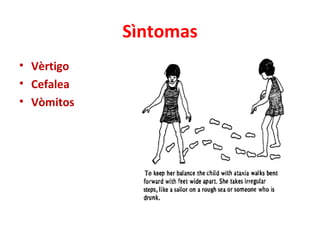 Sìntomas
• Vèrtigo
• Cefalea
• Vòmitos
 