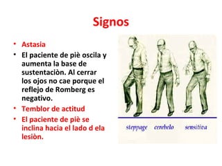 Signos
• Astasia
• El paciente de piè oscila y
  aumenta la base de
  sustentaciòn. Al cerrar
  los ojos no cae porque el
  reflejo de Romberg es
  negativo.
• Temblor de actitud
• El paciente de piè se
  inclina hacia el lado d ela
  lesiòn.
 
