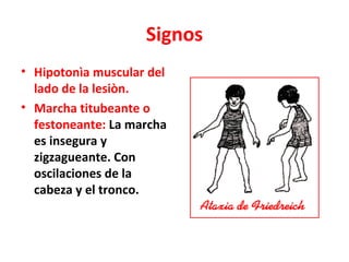 Signos
• Hipotonìa muscular del
  lado de la lesiòn.
• Marcha titubeante o
  festoneante: La marcha
  es insegura y
  zigzagueante. Con
  oscilaciones de la
  cabeza y el tronco.
 