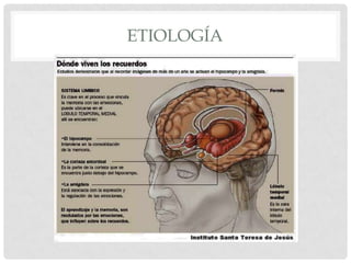 ETIOLOGÍA
 