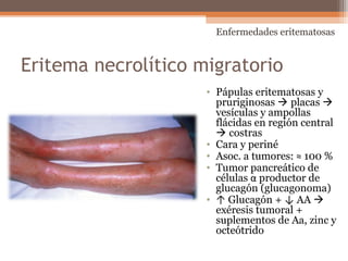 Eritema necrolítico migratorio
• Pápulas eritematosas y
pruriginosas  placas 
vesículas y ampollas
flácidas en región central
 costras
• Cara y periné
• Asoc. a tumores: ≈ 100 %
• Tumor pancreático de
células α productor de
glucagón (glucagonoma)
• ↑ Glucagón + ↓ AA 
exéresis tumoral +
suplementos de Aa, zinc y
octeótrido
Enfermedades eritematosas
 
