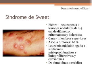 Síndrome de Sweet
• Fiebre + neutropenia +
lesiones nodulares de 1-3
cm de diámetro,
eritematosas y dolorosas
• Cara y miembros superiores
• Asoc. a tumores: 20 %
• Leucemia mieloide aguda >
síndromes
mieloproliferativos y
linfoproliferativos, y
carcinomas
• Dx simultáneo o recidiva
Dermatosis neutrofílicas
 