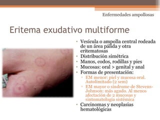 Eritema exudativo multiforme
• Vesícula o ampolla central rodeada
de un área pálida y otra
eritematosas
• Distribución simétrica
• Manos, codos, rodillas y pies
• Mucosas: oral > genital y anal
• Formas de presentación:
▫ EM menor: piel y mucosa oral.
Autolimitado (2 sem)
▫ EM mayor o síndrome de Stevens-
Johnson: más agudo. Al menos
afectación de 2 mucosas y
sintomatología sistémica
• Carcinomas y neoplasias
hematológicas
Enfermedades ampollosas
 