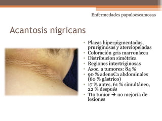 Acantosis nigricans
• Placas hiperpigmentadas,
pruriginosas y aterciopeladas
• Coloración gris marronácea
• Distribucion simétrica
• Regiones intertriginosas
• Asoc. a tumores: 84 %
• 90 % adenoCa abdominales
(60 % gástrico)
• 17 % antes, 61 % simultáneo,
22 % después
• Tto tumor  no mejoría de
lesiones
Enfermedades papuloescamosas
 