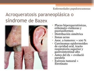 Acroqueratosis paraneoplásica o
síndrome de Bazex
• Placas hiperqueratósicas,
eritemato-violáceas y
psoriasiformes
• Distribución simétrica
• Zonas acras
• Asoc. a tumores: ≈ 100 %
• Carcinomas epidermoides
de cavidad oral, tracto
respiratorio superior y
gastrointestinal alto
• Antes del dx + evolució
paralela
• Exéresis tumoral +
Etretinato
Enfermedades papuloescamosas
 