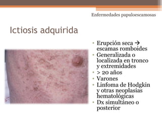 Ictiosis adquirida
• Erupción seca 
escamas romboides
• Generalizada o
localizada en tronco
y extremidades
• > 20 años
• Varones
• Linfoma de Hodgkin
y otras neoplasias
hematológicas
• Dx simultáneo o
posterior
Enfermedades papuloescamosas
 