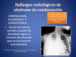 PARÉNQUIMA
PULMONAR ↑
CONSISTENCIA
• Varían de forma,
tamaño y grado de
densidad según el
número de alveolos
que se encuentren
consolidados.
Rohde Einhaus FC, Green Schnecuer León, et al. Neumología. 6°
ed. México: Trillass; 2007
“Opacidad que tiende a ser
homogénea, de bordes más
o menos bien limitados, rara
vez definidos con nitidez y
precisión”
 