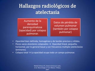 Aumento de la
densidad
parenquimatosa
(opacidad) por colapso
pulmonar.
Datos de pérdida de
volumen pulmonar
(también por colapso
pulmonar)
Rohde Einhaus FC, Green Schnecuer León,
et al. Neumología. 6° ed. México: Trillass;
2007.
• Opacidad bien definida, homogénea y de bordes precisos y nítidos.
• Pocos sacos alveolares colapsados → Opacidad lineal, pequeña,
horizontal, por lo general basal y con frecuencia múltiple (atelectasias
laminares).
• Colapso total → La opacidad ocupa todo un campo pulmonar.
 