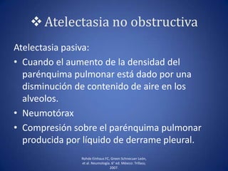 Atelectasia no obstructiva
Atelectasia pasiva:
• Cuando el aumento de la densidad del
parénquima pulmonar está dado por una
disminución de contenido de aire en los
alveolos.
• Neumotórax
• Compresión sobre el parénquima pulmonar
producida por líquido de derrame pleural.
Rohde Einhaus FC, Green Schnecuer León,
et al. Neumología. 6° ed. México: Trillass;
2007.
 