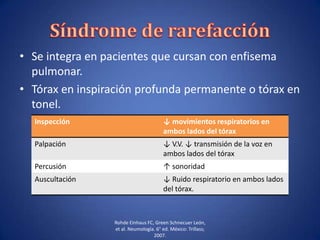 • Se integra en pacientes que cursan con enfisema
pulmonar.
• Tórax en inspiración profunda permanente o tórax en
tonel.
Rohde Einhaus FC, Green Schnecuer León,
et al. Neumología. 6° ed. México: Trillass;
2007.
Inspección ↓ movimientos respiratorios en
ambos lados del tórax
Palpación ↓ V.V. ↓ transmisión de la voz en
ambos lados del tórax
Percusión ↑ sonoridad
Auscultación ↓ Ruido respiratorio en ambos lados
del tórax.
 