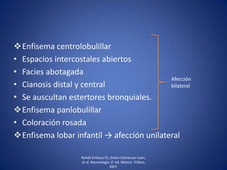 Enfisema centrolobulillar
• Espacios intercostales abiertos
• Facies abotagada
• Cianosis distal y central
• Se auscultan estertores bronquiales.
Enfisema panlobulillar
• Coloración rosada
Enfisema lobar infantil → afección unilateral
Rohde Einhaus FC, Green Schnecuer León,
et al. Neumología. 6° ed. México: Trillass;
2007.
Afección
bilateral
 