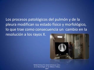 Los procesos patológicos del pulmón y de la
pleura modifican su estado físico y morfológico,
lo que trae como consecuencia un cambio en la
resolución a los rayos X.
Rohde Einhaus FC, Green Schnecuer León,
et al. Neumología. 6° ed. México: Trillass;
2007.
 