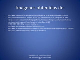 Imágenes obtenidas de:
• http://www.cpicmha.sld.cu/bvs/monografias/ImagenesFrecTorax/tematicas/absceso%20p.htm
• http://skorpiomenlamedicina.blogspot.mx/2011/11/interpretacion-de-las-radiografias-de.html
• http://www.telmeds.org/atlas/radiologia-pediatrica/hallazgos-radiologicos-patologicos/atelectasias/
• http://www.scielo.org.ar/scielo.php?script=sci_arttext&pid=S0325-
00752010000400017&lng=en&nrm=iso&tlng=es
• http://www.neumologica.org/Glosario%20Radilogico.htm
• http://www.archbronconeumol.org/es/normativa-sobre-el-diagnostico-tratamiento/articulo/13125382/
• http://www.radimed.com/galeria/126-Colapsos-atelectasias
Rohde Einhaus FC, Green Schnecuer León,
et al. Neumología. 6° ed. México: Trillass;
2007.
 