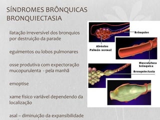 SÍNDROMES BRÔNQUICAS
BRONQUIECTASIA
ilatação irreversível dos bronquios
por destruição da parade
eguimentos ou lobos pulmonares
osse produtiva com expectoração
mucopurulenta - pela manhã
emoptise
xame físico variável dependendo da
localização
asal – diminuição da expansibilidade
 