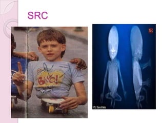 SRC
 