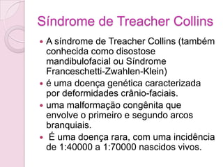 Síndrome de Treacher Collins
 A síndrome de Treacher Collins (também
  conhecida como disostose
  mandibulofacial ou Síndrome
  Franceschetti-Zwahlen-Klein)
 é uma doença genética caracterizada
  por deformidades crânio-faciais.
 uma malformação congênita que
  envolve o primeiro e segundo arcos
  branquiais.
 É uma doença rara, com uma incidência
  de 1:40000 a 1:70000 nascidos vivos.
 