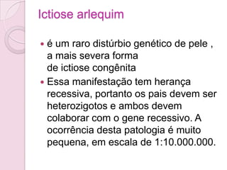 Ictiose arlequim

 é um raro distúrbio genético de pele ,
  a mais severa forma
  de ictiose congênita
 Essa manifestação tem herança
  recessiva, portanto os pais devem ser
  heterozigotos e ambos devem
  colaborar com o gene recessivo. A
  ocorrência desta patologia é muito
  pequena, em escala de 1:10.000.000.
 