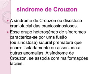 síndrome de Crouzon
 A síndrome de Crouzon ou disostose
  craniofacial das craniossinostoses.
 Esse grupo heterogêneo de síndromes
  caracteriza-se por uma fusão
  (ou sinostose) sutural prematura que
  ocorre isoladamente ou associada a
  outras anomalias. A síndrome de
  Crouzon, se associa com malformações
  faciais.
 