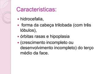 Caracteristicas:
 hidrocefalia,
 forma da cabeça trilobada (com três
  lóbulos),
 órbitas rasas e hipoplasia
 (crescimento incompleto ou
  desenvolvimento incompleto) do terço
  médio da face.
 